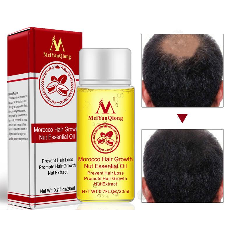 Natural Hair Growth Serum for Thicker, Fuller Hair by HitMyNeed