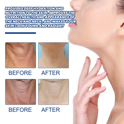 Neck Firming Protein Cream for Lines & Double Chin by HitMyNeed