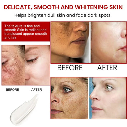 Niacinamide Melasma Brightening Cream 20g by HitMyNeed