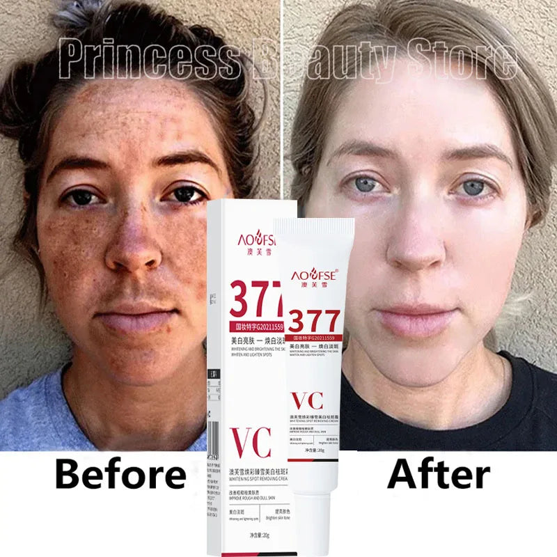 Niacinamide Melasma Brightening Cream 20g by HitMyNeed