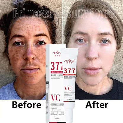 Niacinamide Melasma Brightening Cream 20g by HitMyNeed