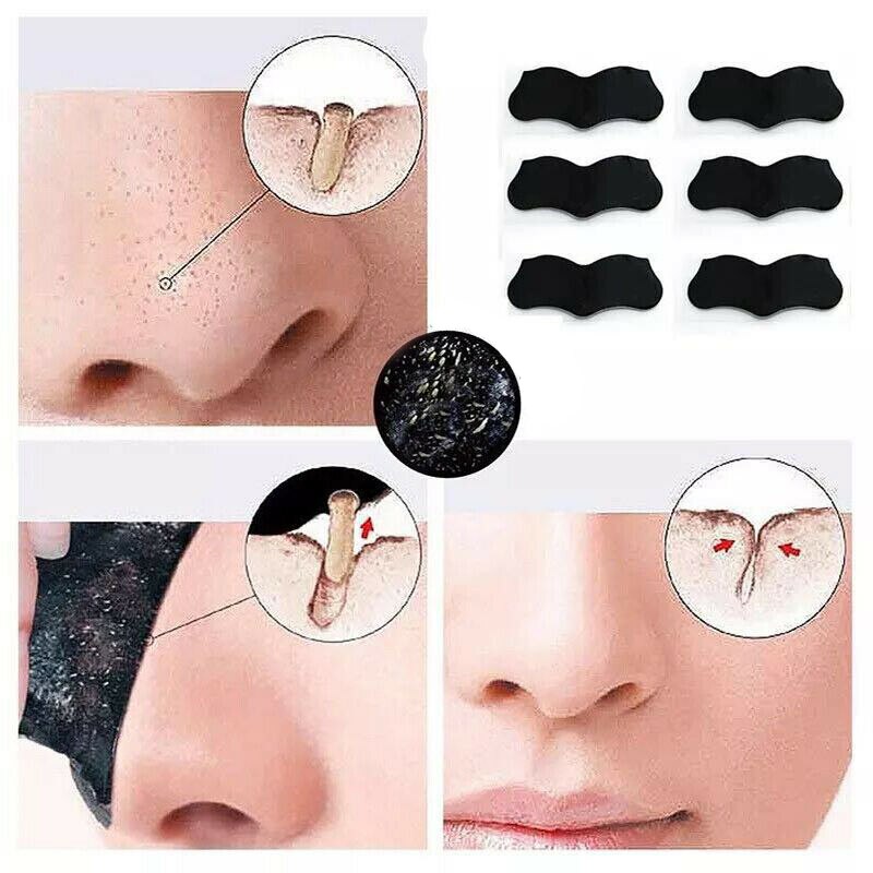 Nose Pore Strips Blackhead Remover (50 Pack) by HitMyNeed