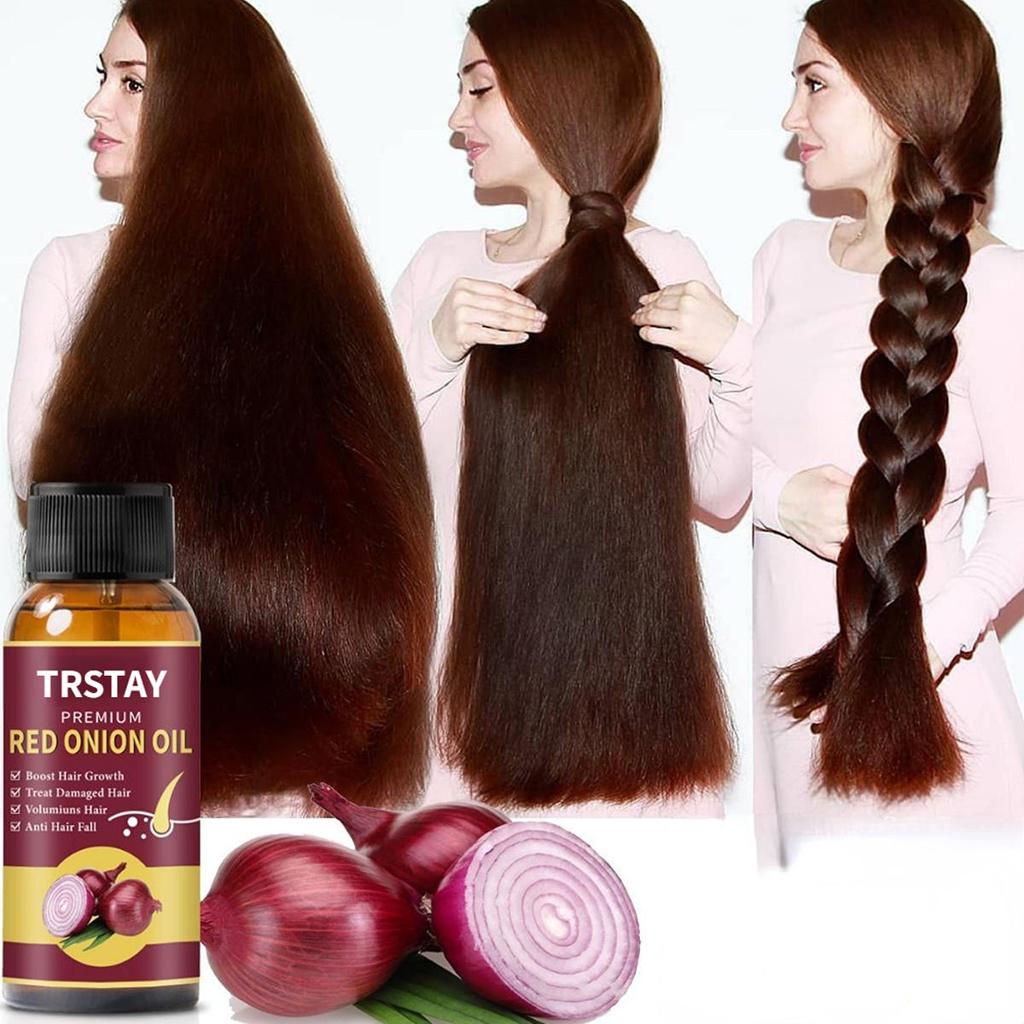 Onion & Black Seed Hair Growth Oil Spray 5ml by HitMyNeed