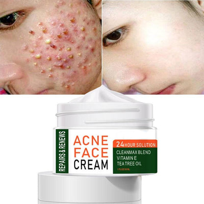 Organic Tea Tree Acne Spot & Dark Spot Cream 30g by HitMyNeed