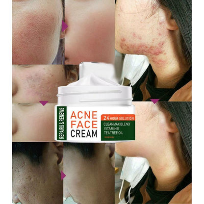 Organic Tea Tree Acne Spot & Dark Spot Cream 5g by HitMyNeed