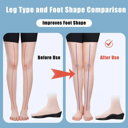 Orthotic Insoles for Plantar Fasciitis & Flat Feet Support by HitMyNeed