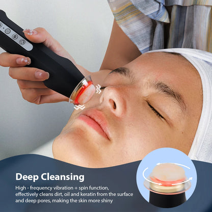Oxygen Bubble Pen CO2 Portable Facial Machine by HitMyNeed