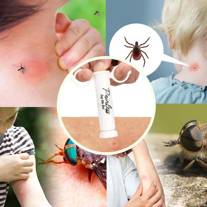 Painless Mosquito Bite Extractor Tool by HitMyNeed