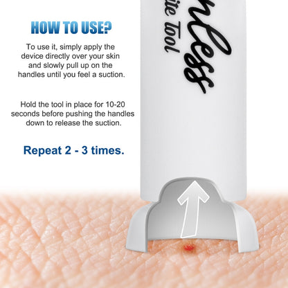 Painless Mosquito Bite Extractor Tool by HitMyNeed