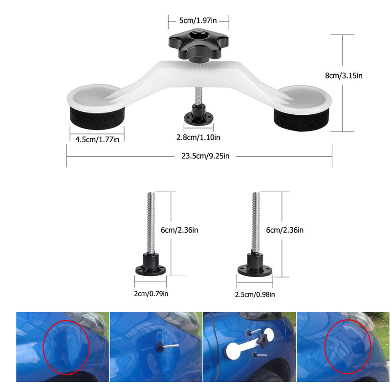 Paintless Dent Repair Kit for Cars and Appliances by HitMyNeed