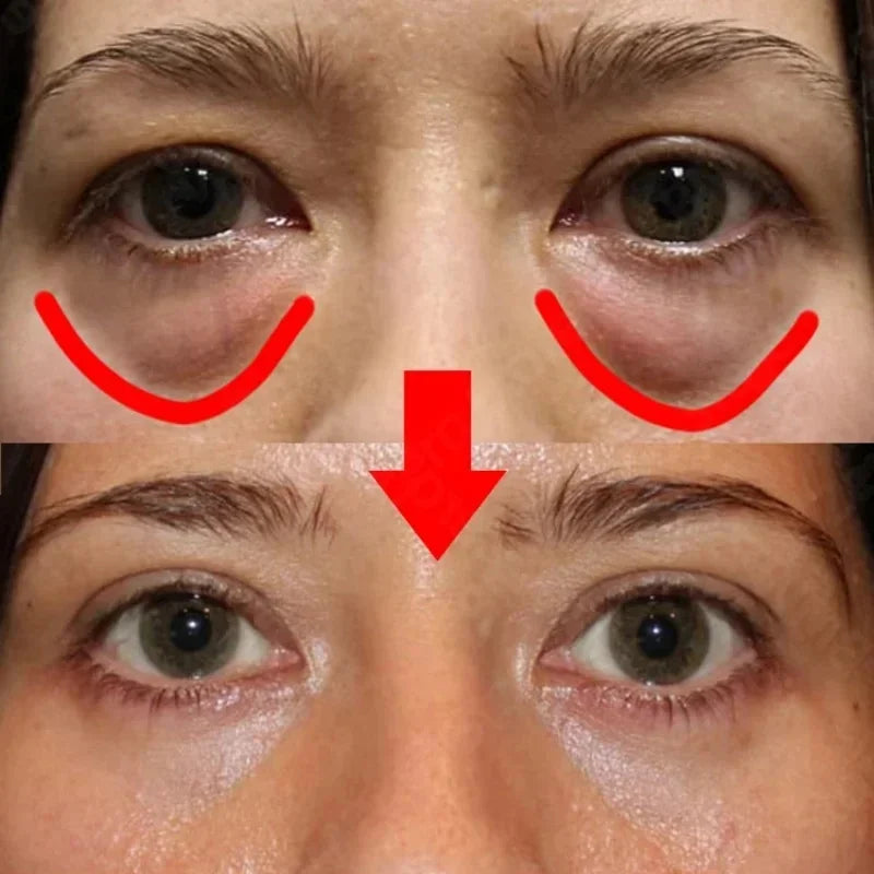 Peptide Anti-Wrinkle Eye Cream for Dark Circles by HitMyNeed