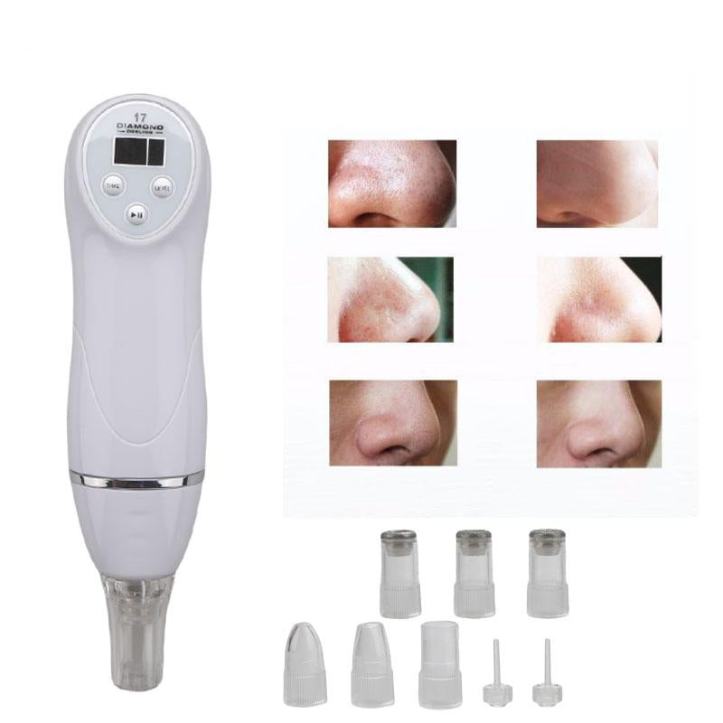 Personal Home Diamond Peel Microdermabrasion Device by HitMyNeed