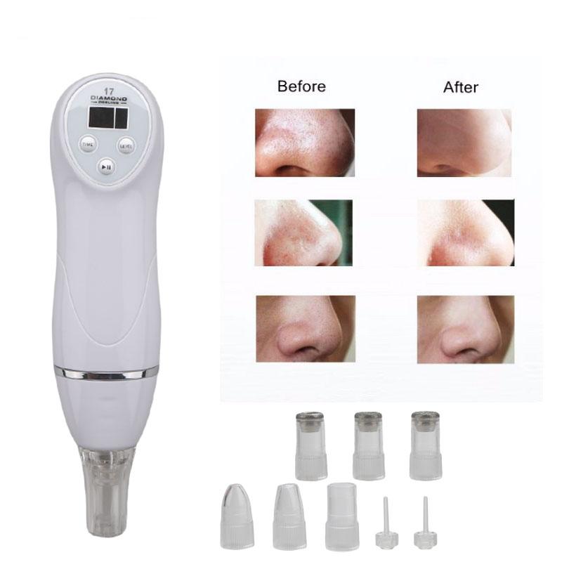 Personal Home Diamond Peel Microdermabrasion Device by HitMyNeed