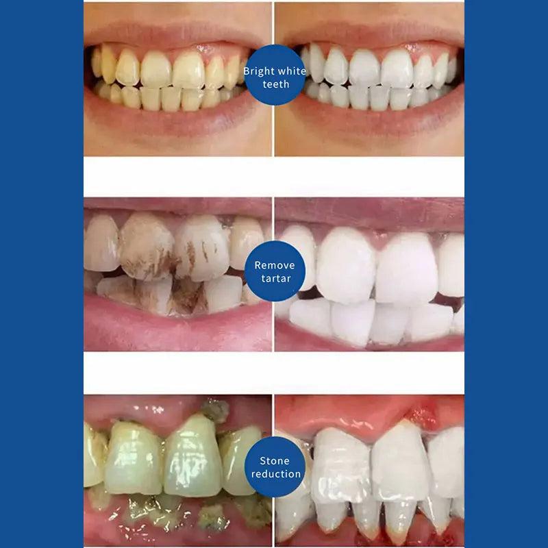 Plaque Control & Whitening Toothpaste 100g by HitMyNeed