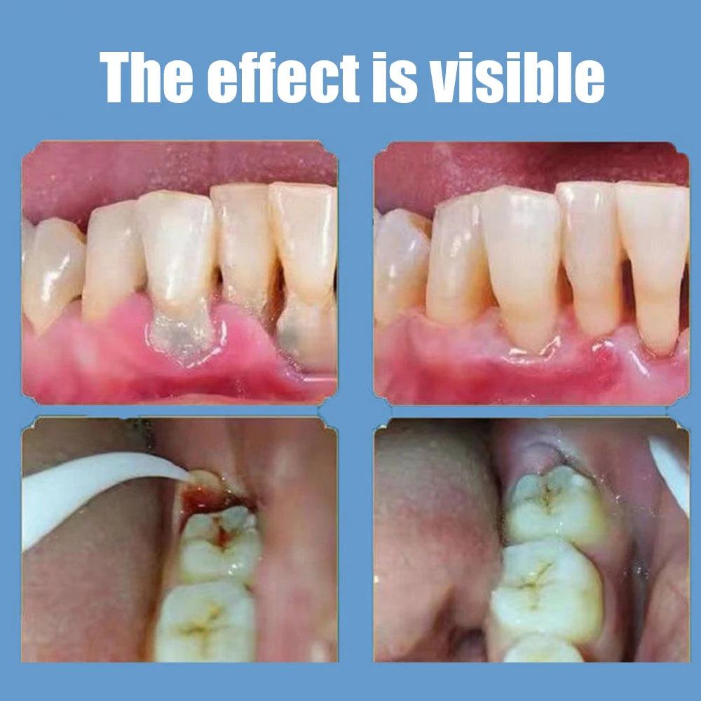 Plaque Control & Whitening Toothpaste 100g by HitMyNeed