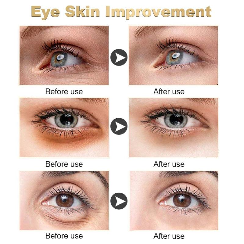 Polypeptide Dark Circle & Eye Bag Correcting Cream by HitMyNeed