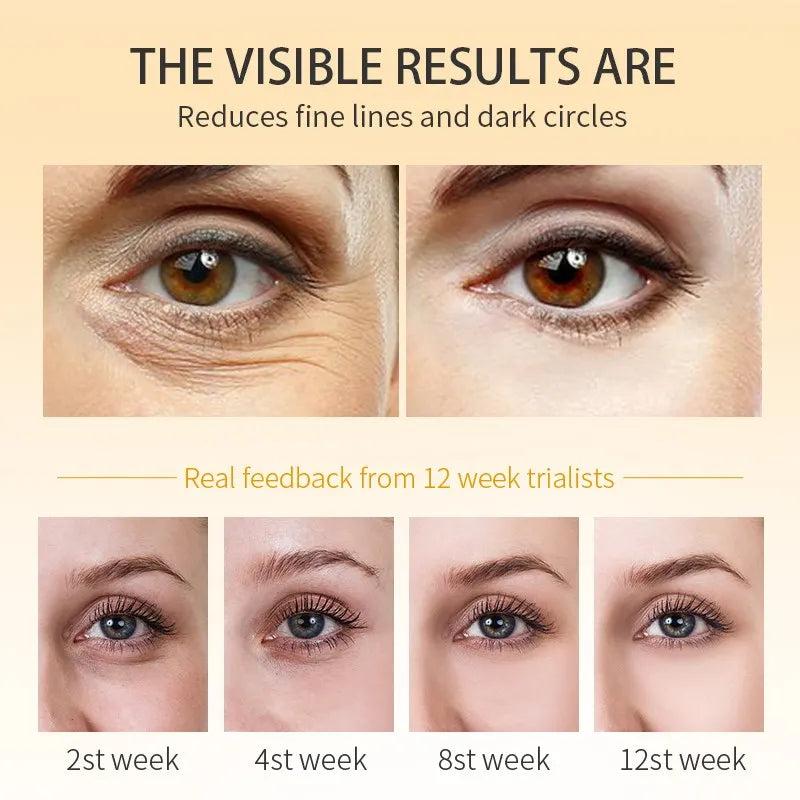 Polypeptide Dark Circle & Eye Bag Correcting Cream by HitMyNeed