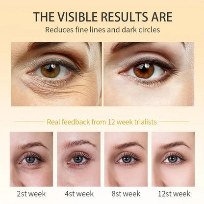 Polypeptide Dark Circle & Eye Bag Correcting Cream by HitMyNeed