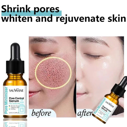Pore Refining Face Serum for Tight, Smooth Skin 10ml by HitMyNeed
