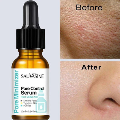 Pore Refining Face Serum for Tight, Smooth Skin 10ml by HitMyNeed