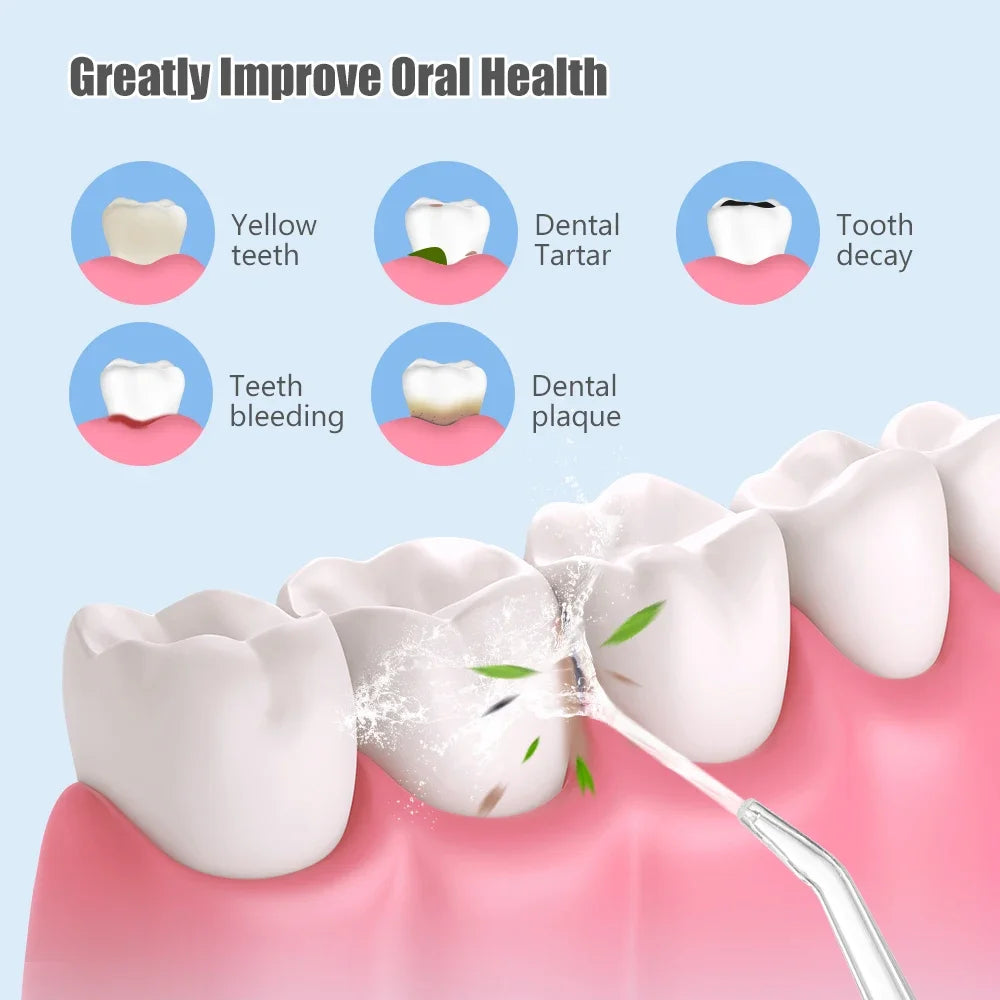 Portable Dental Water Jet Oral Irrigator, 3 Modes by HitMyNeed