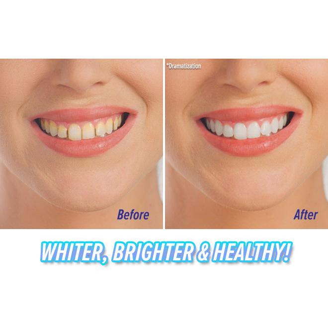 Portable Sonic Teeth Cleaner & Whitener by HitMyNeed