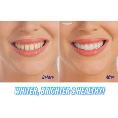 Portable Sonic Teeth Cleaner & Whitener by HitMyNeed