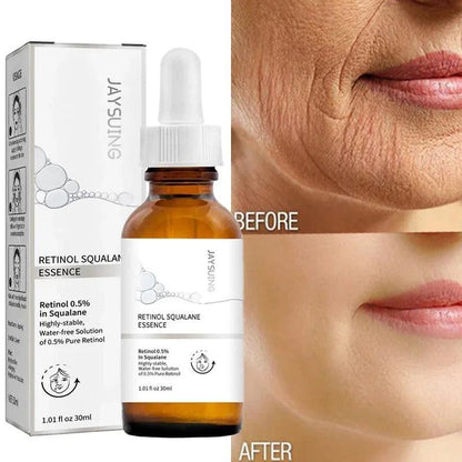 Pure Retinol 0.5% Face Serum with Squalane 30ml by HitMyNeed