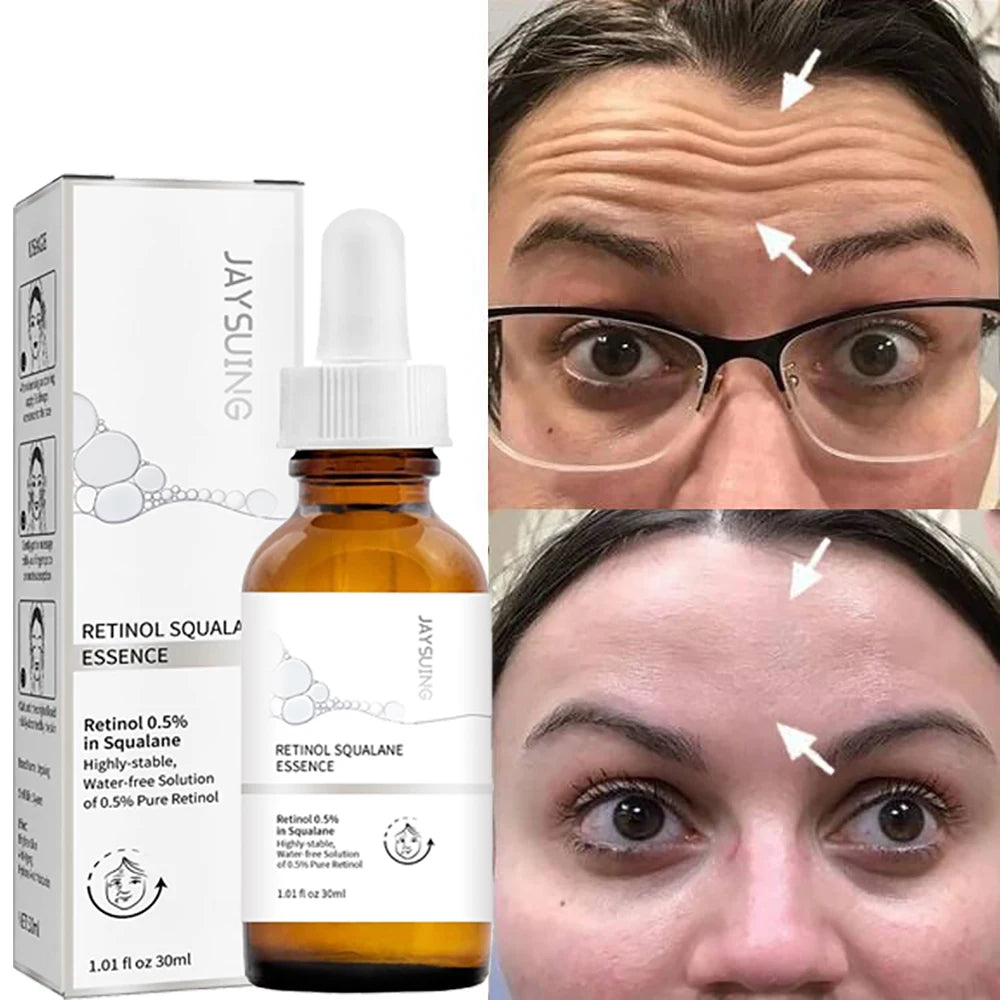 Pure Retinol 0.5% Face Serum with Squalane 30ml by HitMyNeed
