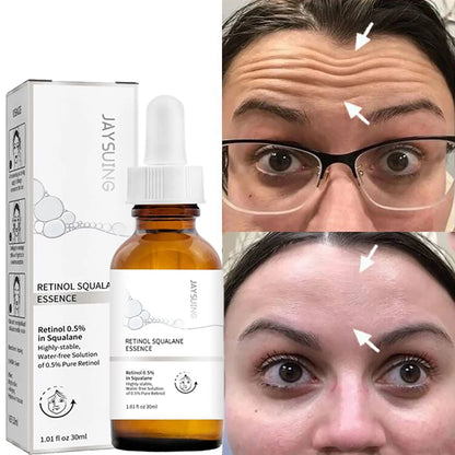 Pure Retinol 0.5% Face Serum with Squalane 30ml by HitMyNeed