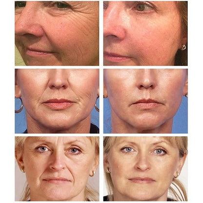 Pure Retinol 0.5% Face Serum with Squalane 30ml by HitMyNeed