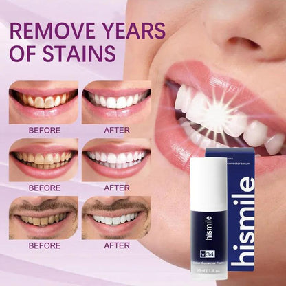 Purple Whitening Toothpaste for Stain Removal by HitMyNeed