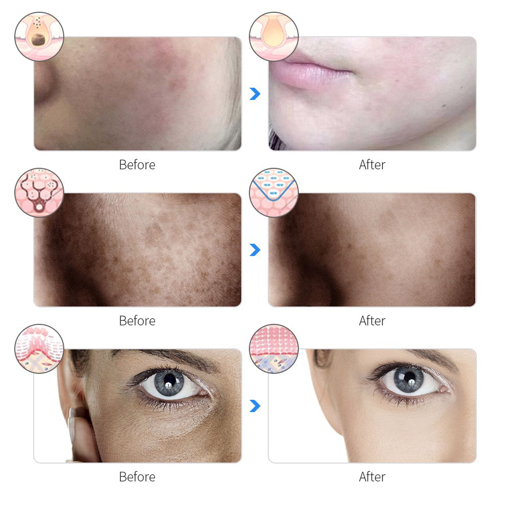 Rechargeable 7-Color LED Photon Facial Mask by HitMyNeed
