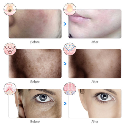 Rechargeable 7-Color LED Photon Facial Mask by HitMyNeed
