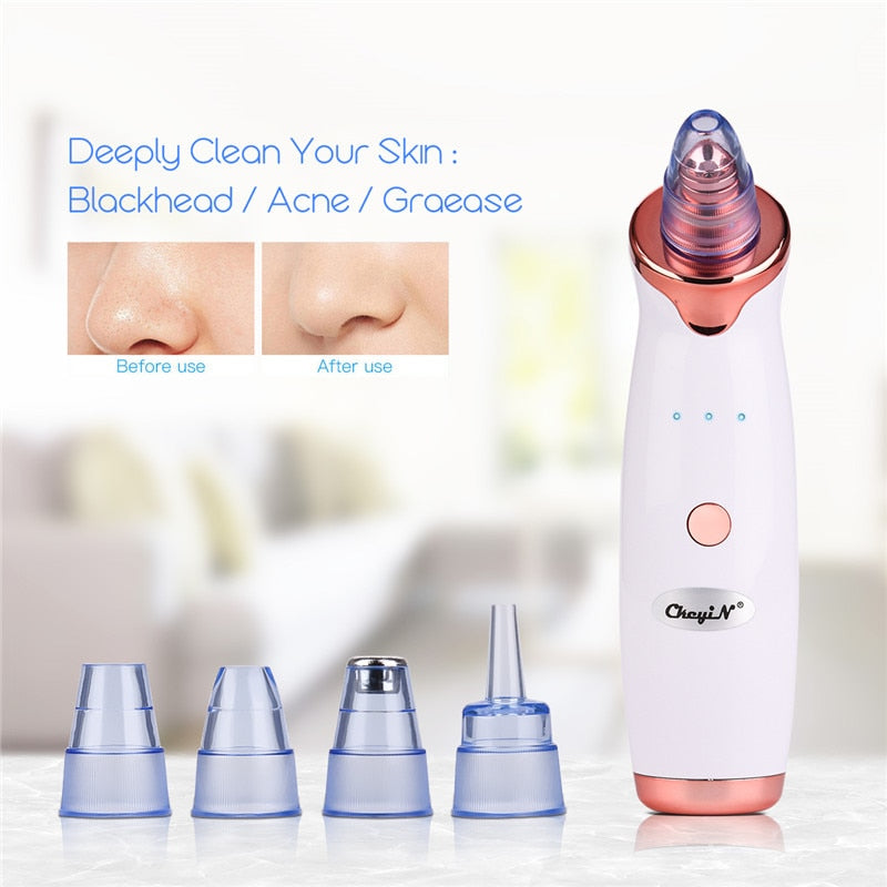 Rechargeable Blackhead Vacuum Pore Cleaner by HitMyNeed