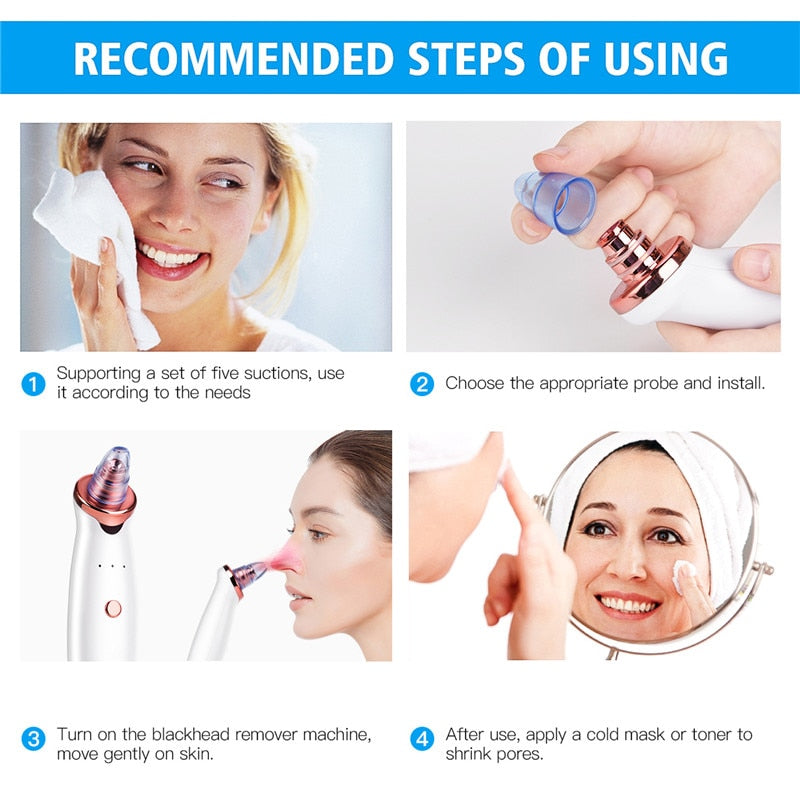 Rechargeable Blackhead Vacuum Pore Cleaner by HitMyNeed