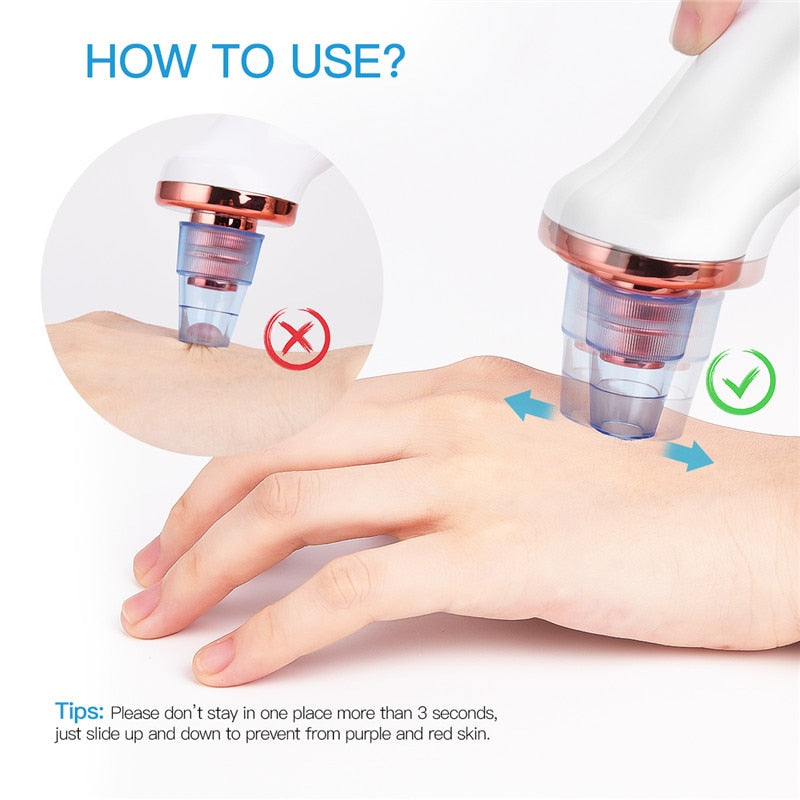 Rechargeable Blackhead Vacuum Pore Cleaner by HitMyNeed