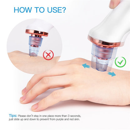 Rechargeable Blackhead Vacuum Pore Cleaner by HitMyNeed