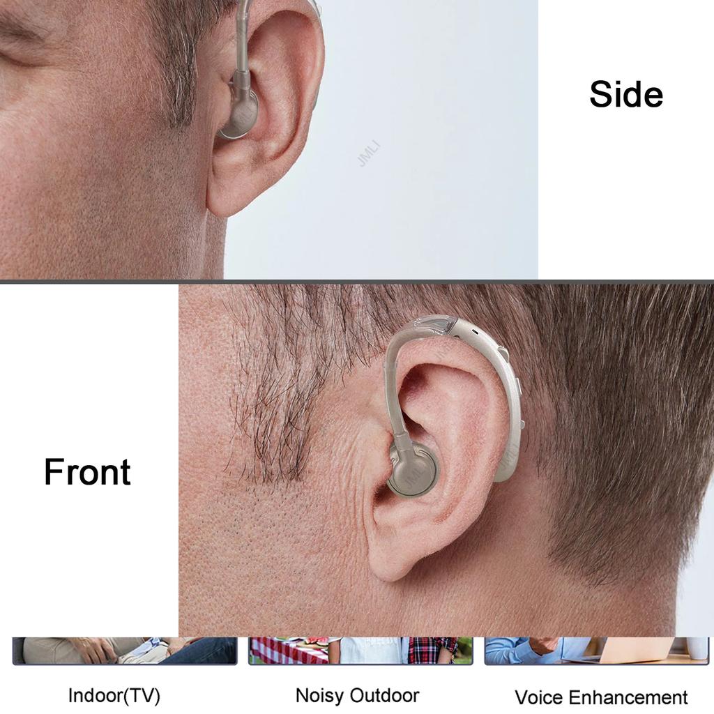 Rechargeable Digital BTE Hearing Aid with Tone Control by HitMyNeed