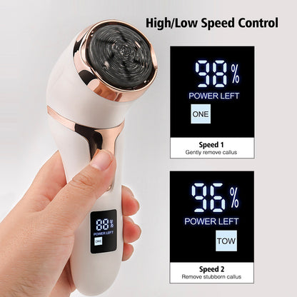 Rechargeable Electric Foot Callus Remover Kit by HitMyNeed
