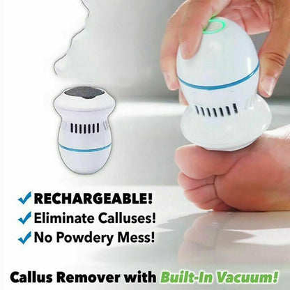 Rechargeable Electric Foot Grinder with Vacuum by HitMyNeed