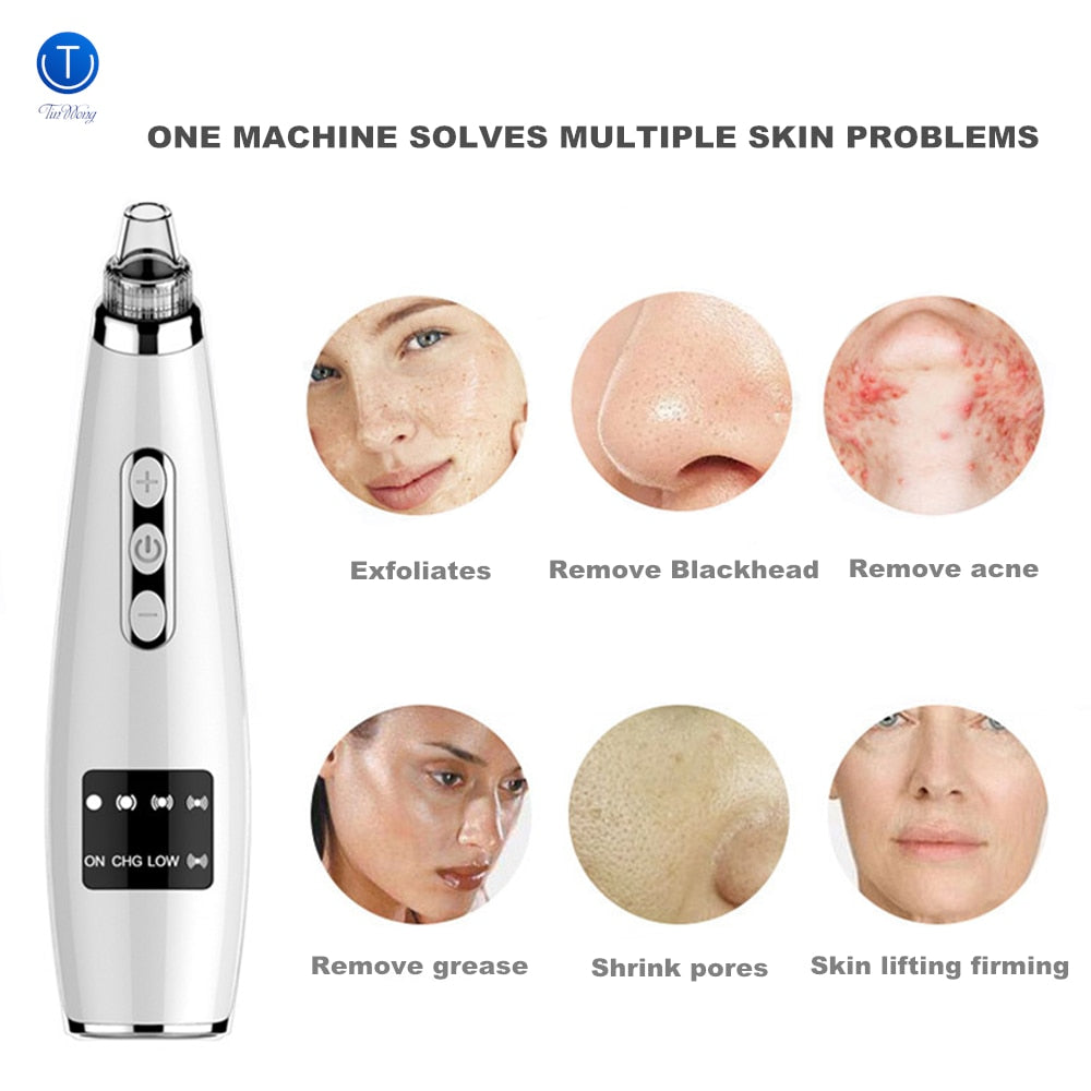 Rechargeable Electric Pore Cleaner Face Tool by HitMyNeed
