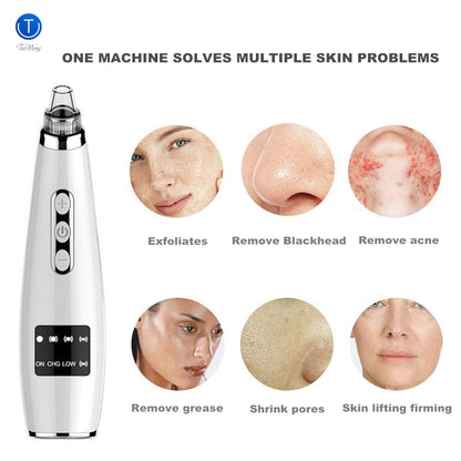 Rechargeable Electric Pore Cleaner Face Tool by HitMyNeed