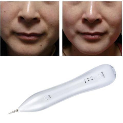 Rechargeable Mole and Skin Tag Removal Pen by HitMyNeed