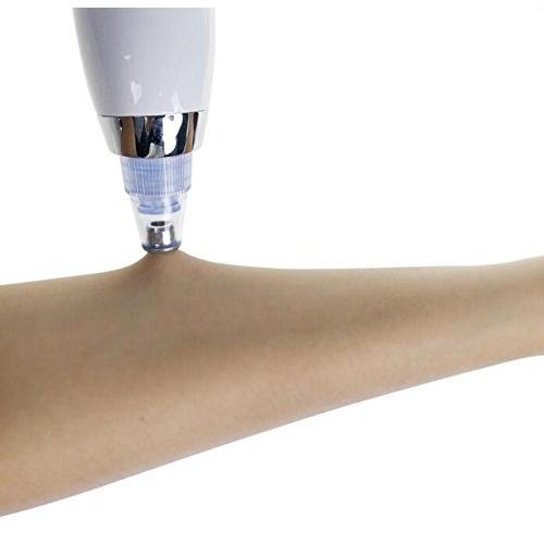 Rechargeable Vacuum Pore Cleaner & Blackhead Remover by HitMyNeed