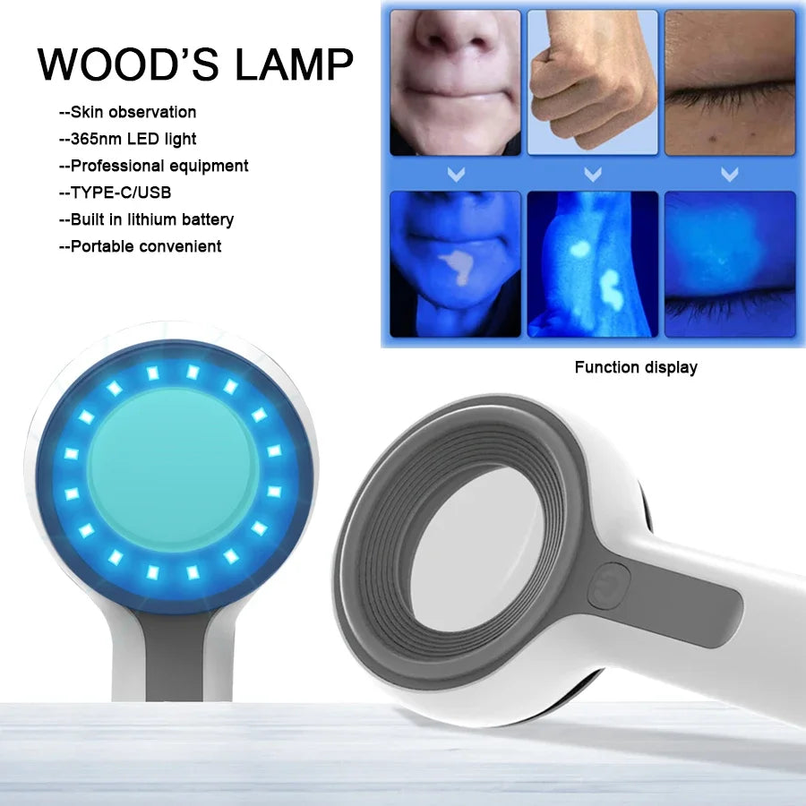 Rechargeable Wood's Lamp UV Skin Analyzer DW-A100 by HitMyNeed