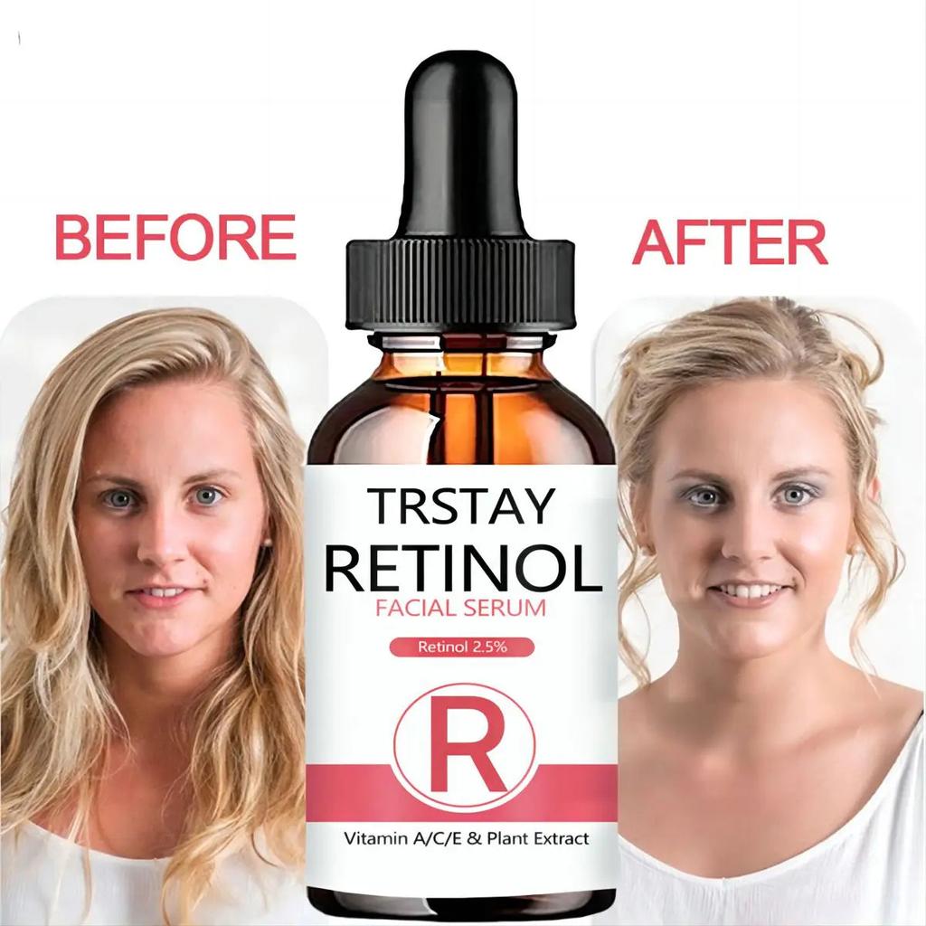 Retinol 2.5% Face Serum with Hyaluronic Acid 30ml by HitMyNeed