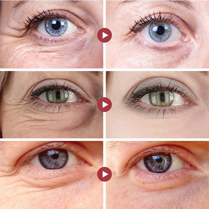 Retinol Anti-Wrinkle Eye Cream for Dark Circles by HitMyNeed