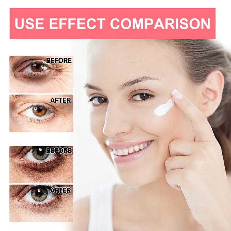 Retinol Anti-Wrinkle Eye Cream for Dark Circles by HitMyNeed