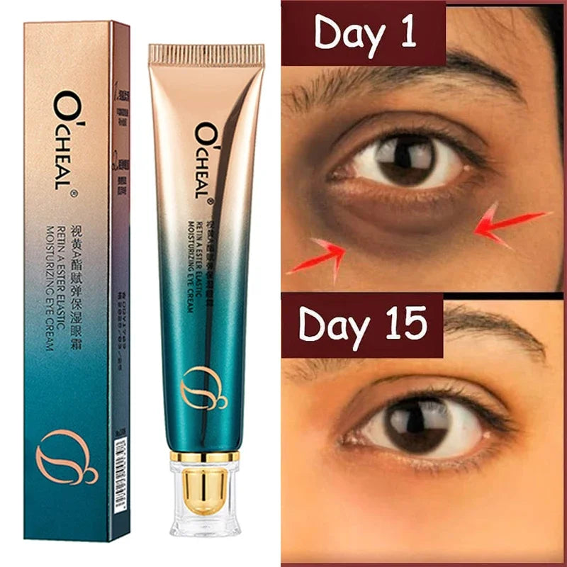 Retinol Anti-Wrinkle Eye Cream for Fine Lines by HitMyNeed